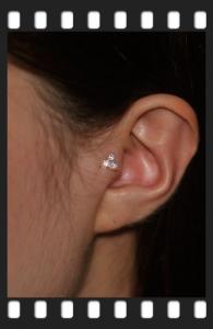 3 Stone Trident 3 Stone Trident