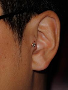 トラガス トラガス