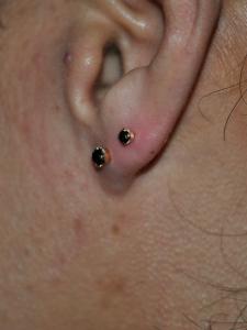 ブラックダイヤモンド ブラックダイヤモンド