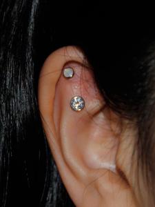 アウターコンク アウターコンク