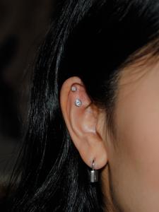 アウターコンク アウターコンク