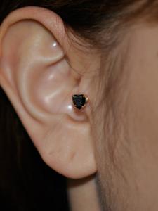 トラガス トラガス