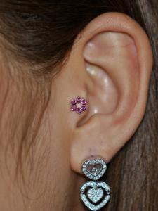 トラガス トラガス