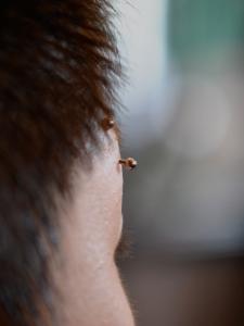 排除作用 排除作用