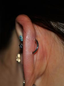 軟骨オービタル 軟骨オービタル