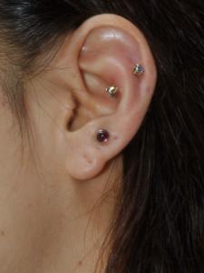 アンチトラガス アンチトラガス