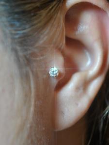 トラガス トラガス