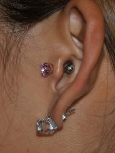 トラガス トラガス