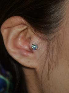 トラガス トラガス