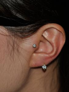 トラガス トラガス