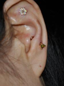 アンチトラガス アンチトラガス