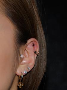 アウターコンク アウターコンク