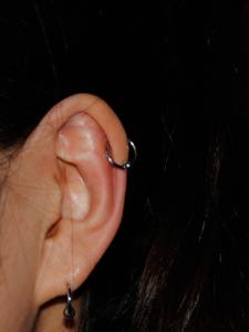 ヘリックス ヘリックス