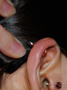 金メダル 金メダル