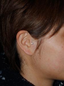 トラガス トラガス