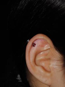 ヘリックス ヘリックス