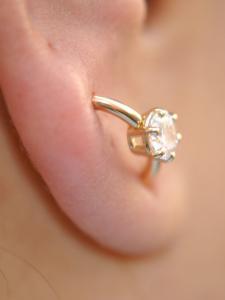 5ミリ キャプティブ 5ミリ キャプティブ