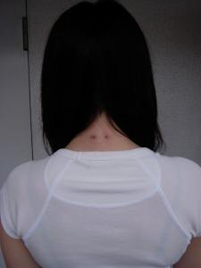 首の後ろ 首の後ろ