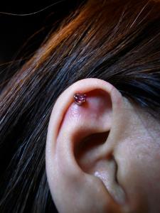 フォッサ フォッサ