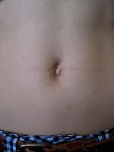 Before Before