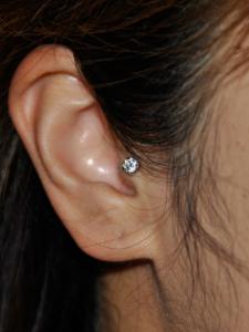 トラガス トラガス