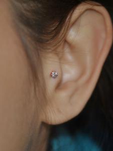 Tragus Tragus