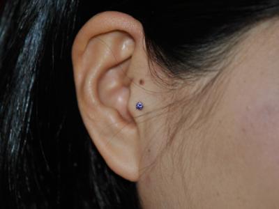 トラガス トラガス