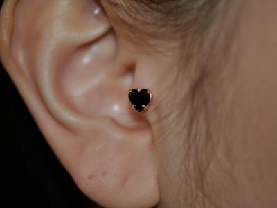 ブラックジルコニア ブラックジルコニア