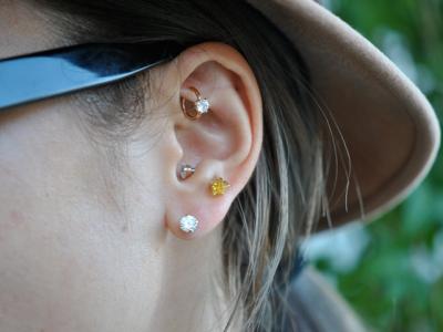 アンチトラガス アンチトラガス