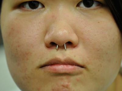 セプタム セプタム