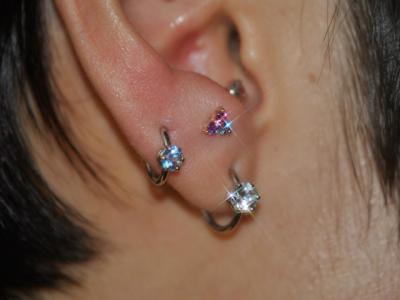 アンチトラガス アンチトラガス