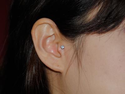 トラガス トラガス