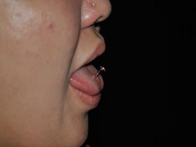 舌ピアス 舌ピアス