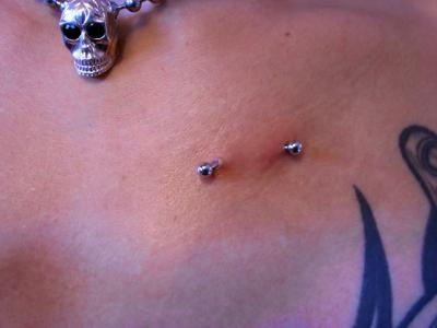 Before Before