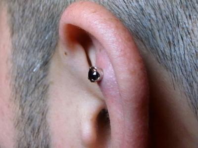 ブラックジルコニア ブラックジルコニア