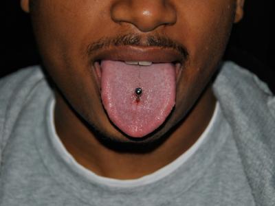 Tongue Tongue