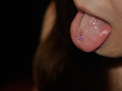 ピンクジルコニア ピンクジルコニア