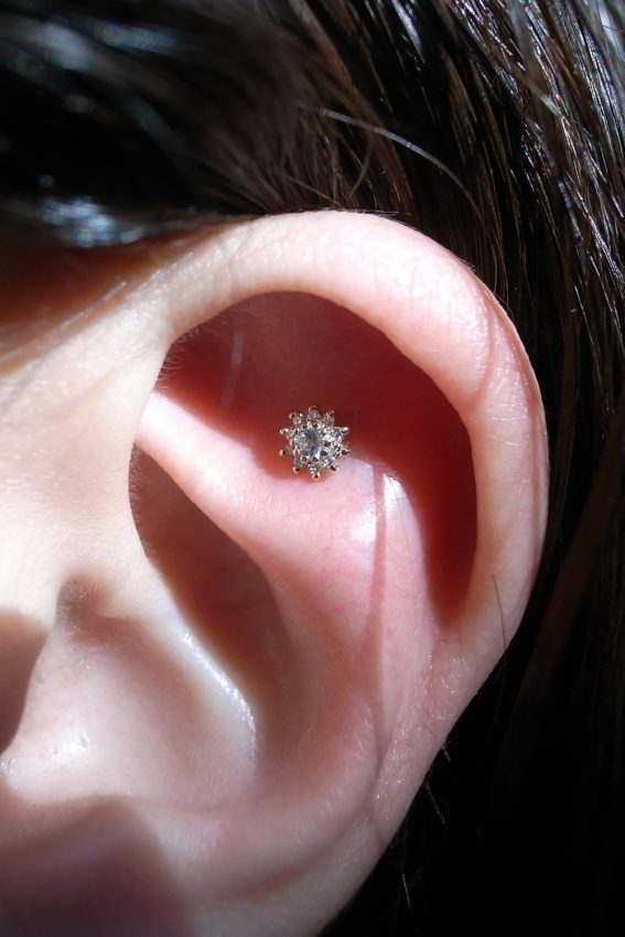 アウターコンク